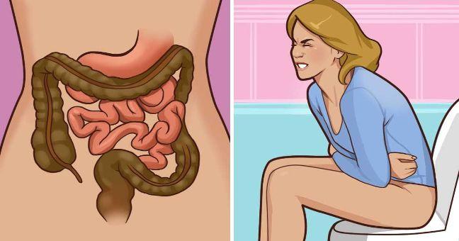 Quick Home Remedies to Relieve Constipation