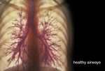 Pictures of Lungs with COPD
