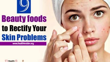 Take the pressure off your skin-care products and stock up on these 9 healthy foods good for skin that nourish from the inside and out. #skincaretips #skintreatments #skinproblems